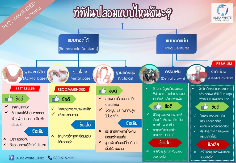 อินโฟกราฟิกเปรียบเทียบฟันปลอมถอดได้และติดแน่น ฐานอะคริลิก ฐานโลหะ วาลพลาส ครอบฟัน รากเทียม คลินิกทันตกรรม AuraWhite บางพลี